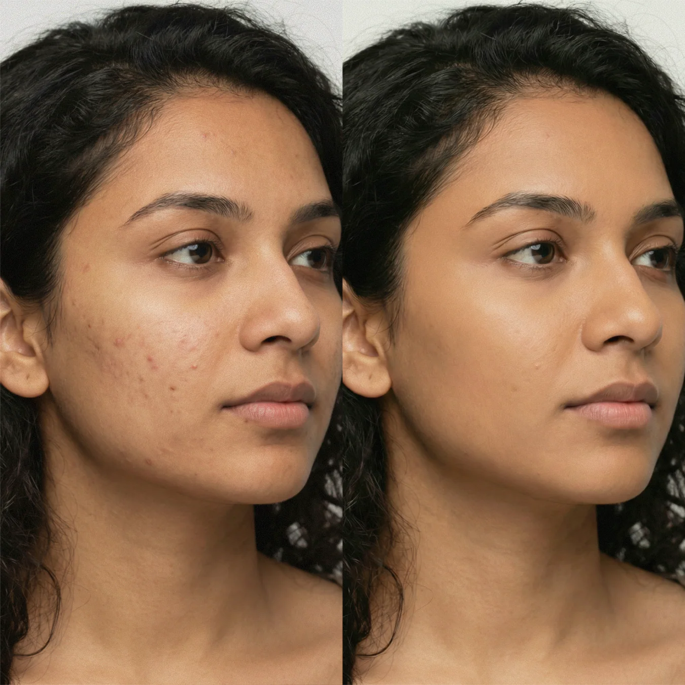 AmazingCosmetics Water-Resistant Antioxidant-Rich Amazing Concealer - Image 18