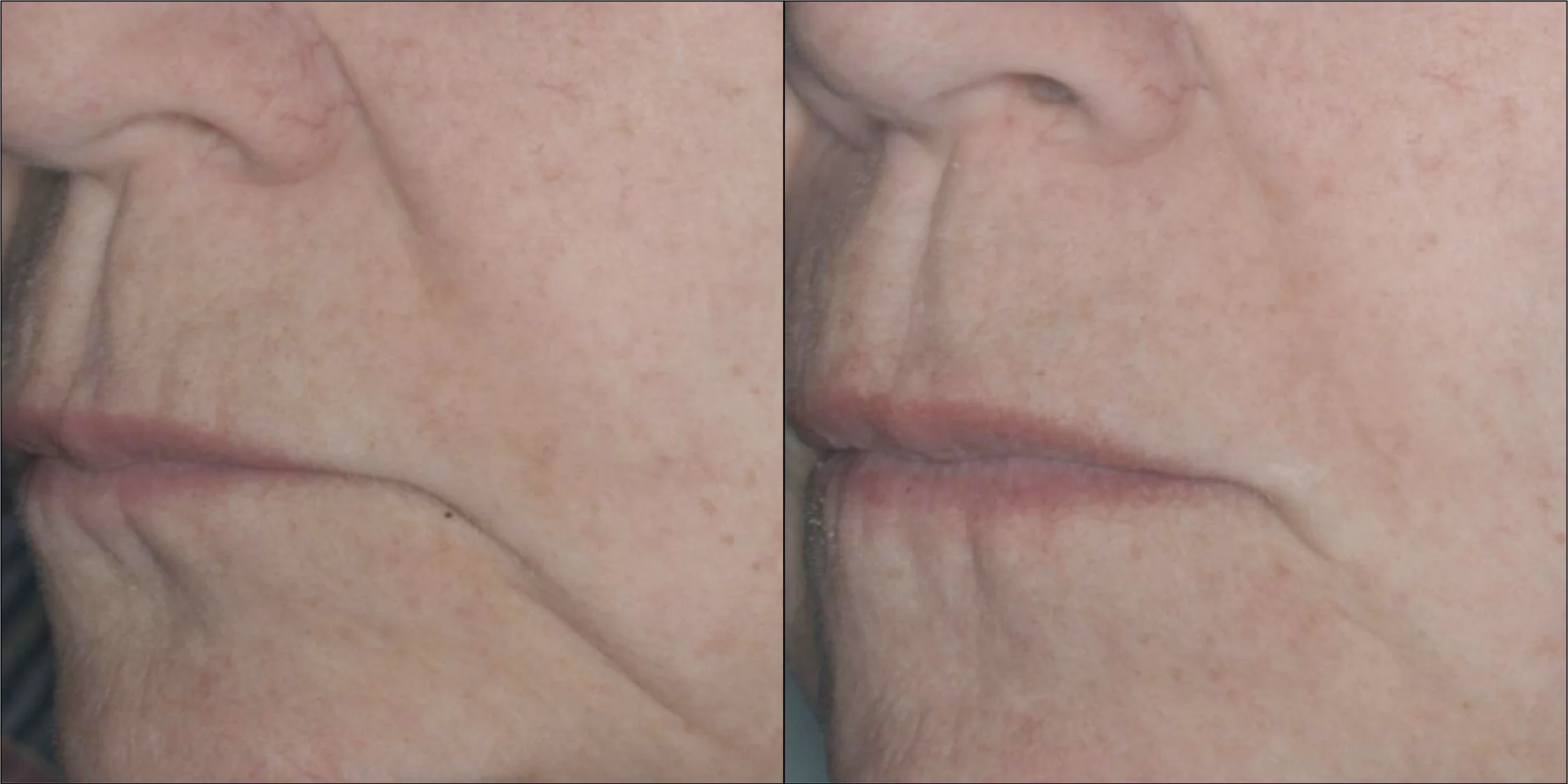 Isomers Skincare Phytocell Rejuvenating Serum BOGO - Image 2