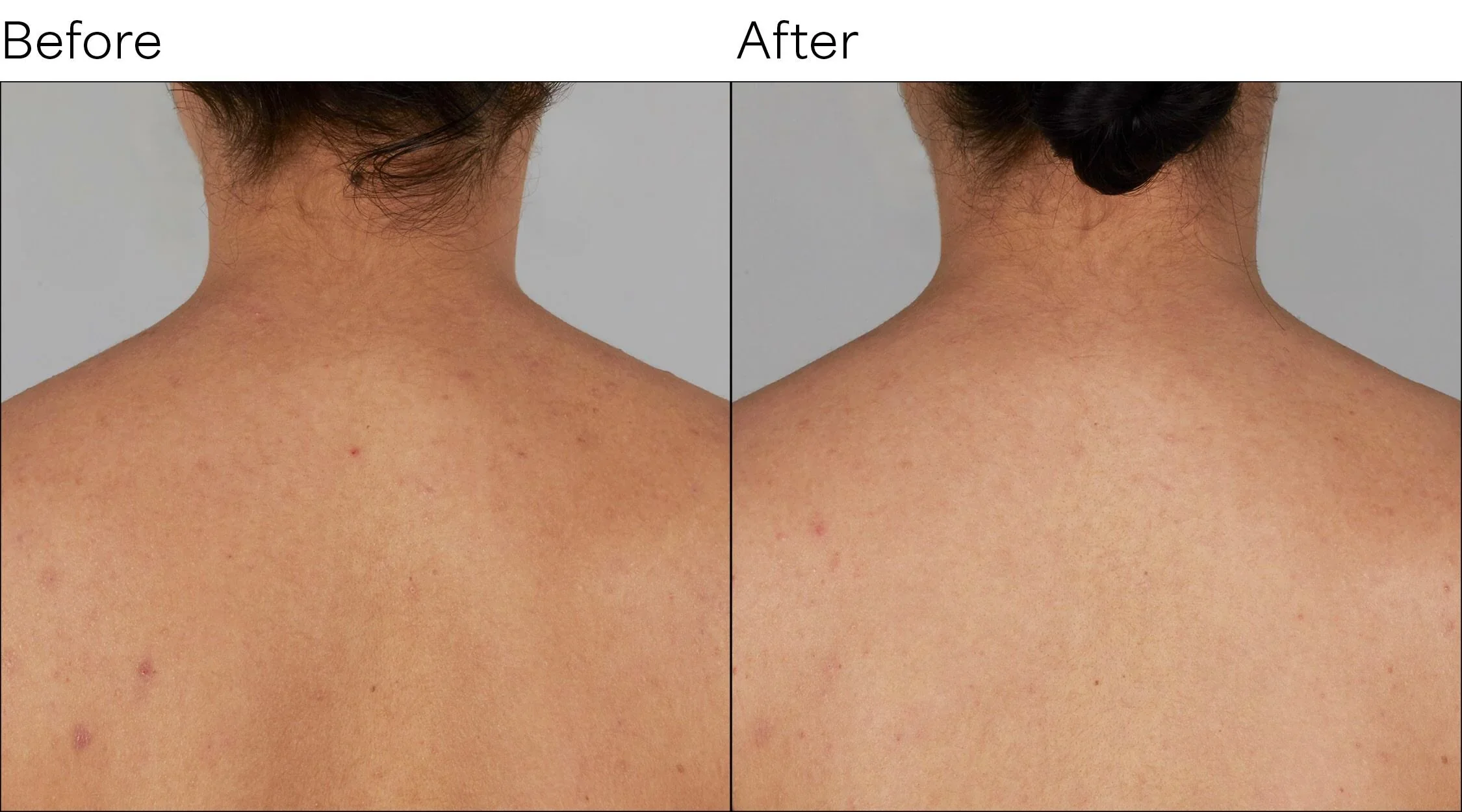 Isomers Skincare Vitamin C After Sun Body Cream 240ml - Image 2
