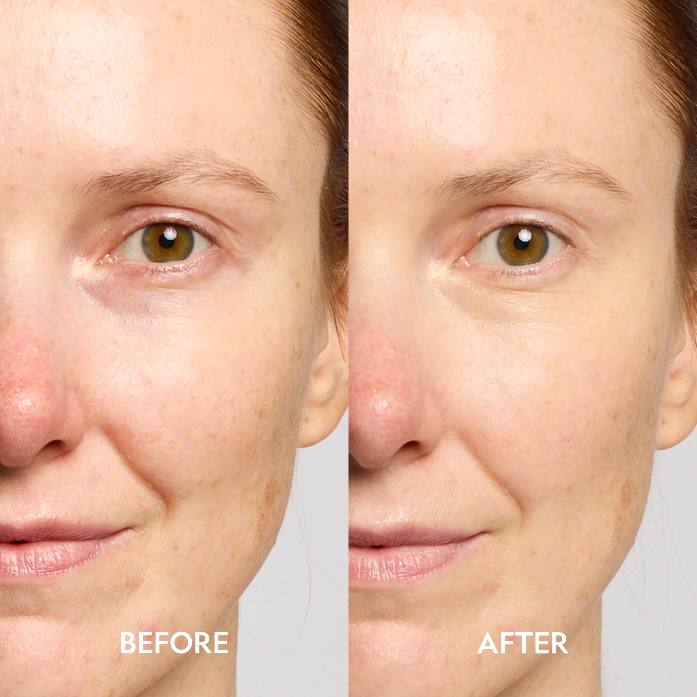 YENSA Super Bright Dark Circle Serum Peptide Corrector - Image 7